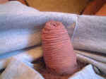 wrinkled skin on penile shaft